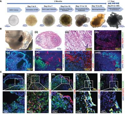 TP53-PTEN-NF1 depletion in human brain organoids produces a glioma phenotype in vitro